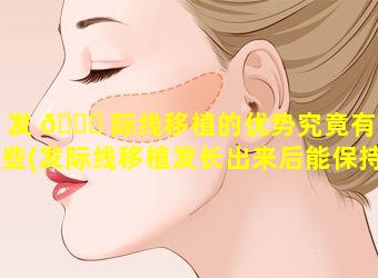 发 🍁 际线移植的优势究竟有哪些(发际线移植发长出来后能保持几年)